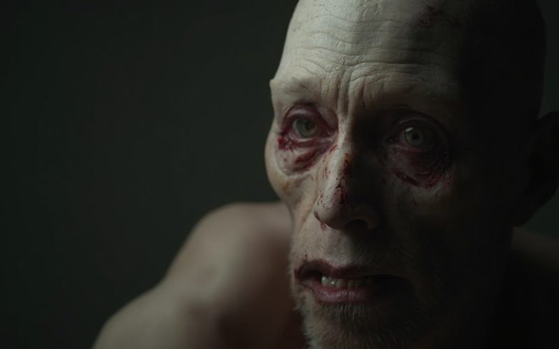 alcohol dependency detrimental physical transformation