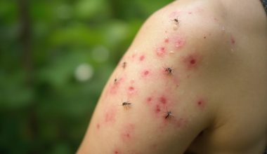 mosquito attracting individual biological factors