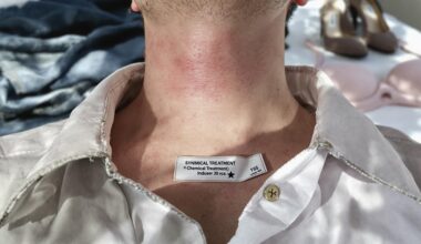 clothing hazards for health