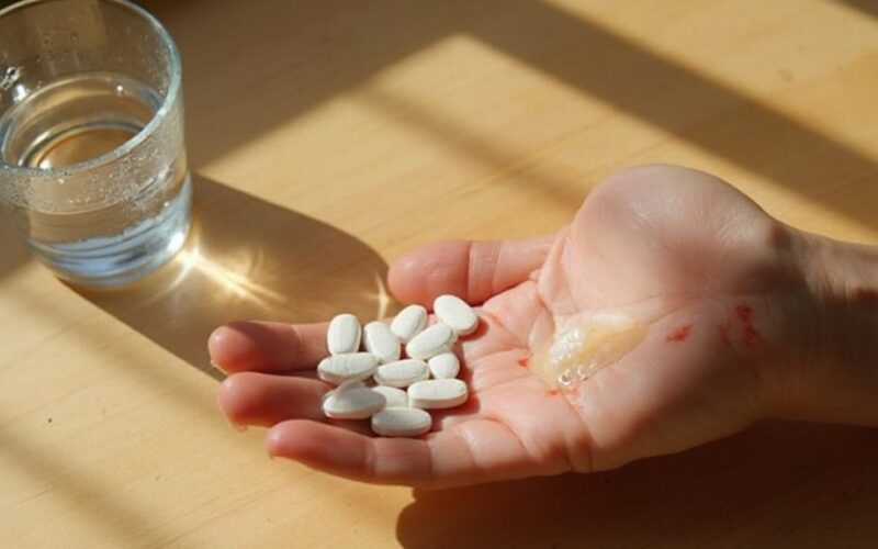 vitamin d excess subtle symptoms