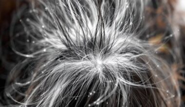 stress causes hair loss