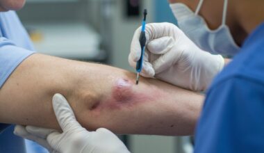 bruising risks for vulnerable groups