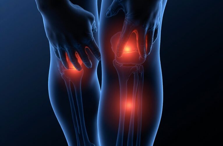 joint deterioration s main cause identified