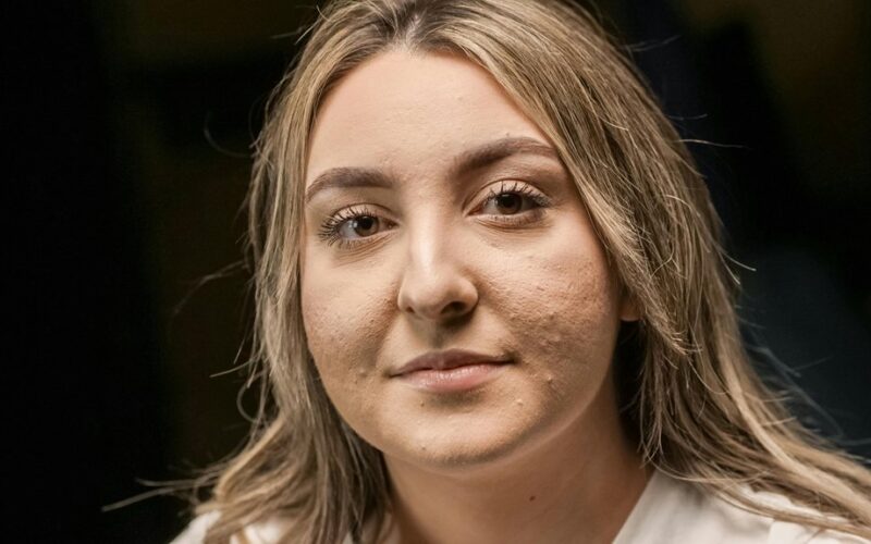 foods that damage skin