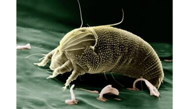 pagaliau atsikračiau dulkių erkių