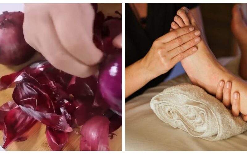 močiutės svogūnų luobelės tepalas