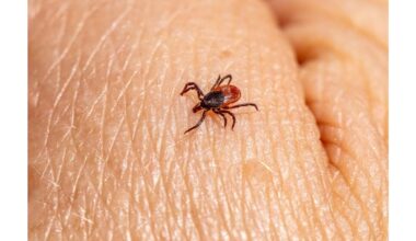 ji nekenčia šito kvapo