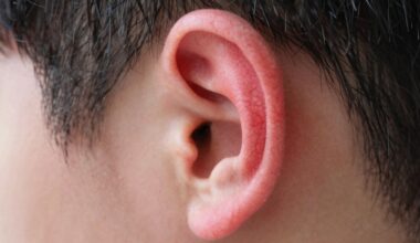 ausys parausta nuo gandų