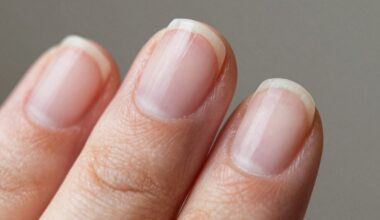 trūksta nagų pusmėnulio (lunulos)