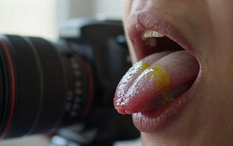 rytinis liežuvis signalizuoja apie kepenis