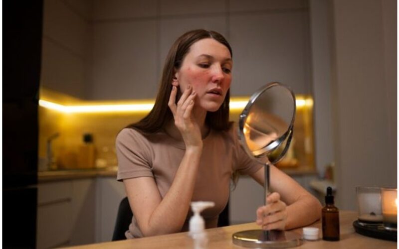 po kosmetinės procedūros komplikacijų priežiūra