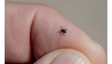 erkės puola dažniausiai įkandimų vietos