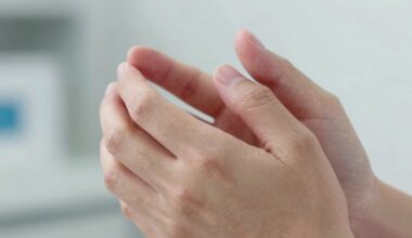 kodėl rankos pradeda tirpti