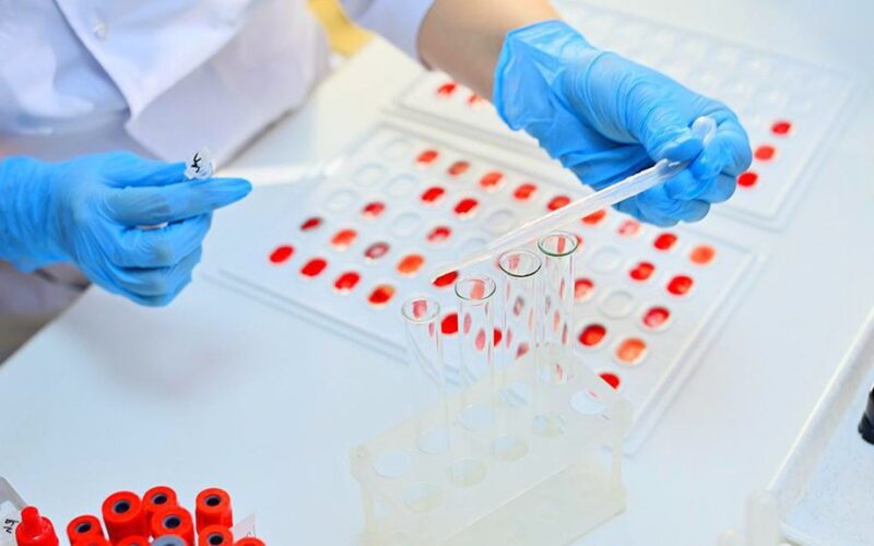 kraujo grupė įtakoja priklausomybės alkoholiui riziką