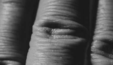 kaip atkurti jaunatvišką odą