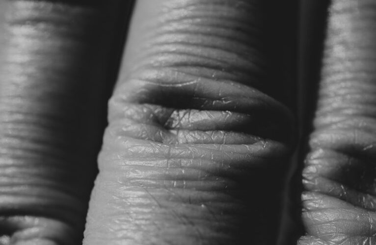 kaip atkurti jaunatvišką odą