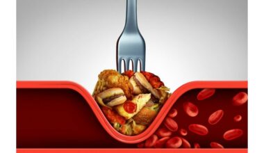 arterijų užsikimšimo požymiai