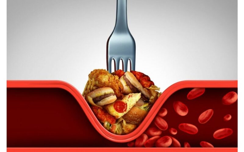 arterijų užsikimšimo požymiai