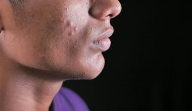 odos dėmių spalvos rodo organus