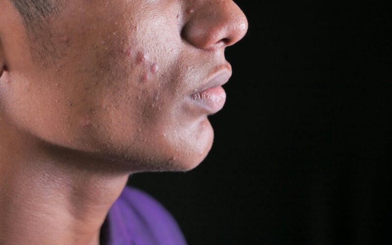 odos dėmių spalvos rodo organus