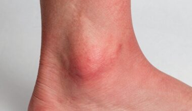 staiga patinusi raudona koja