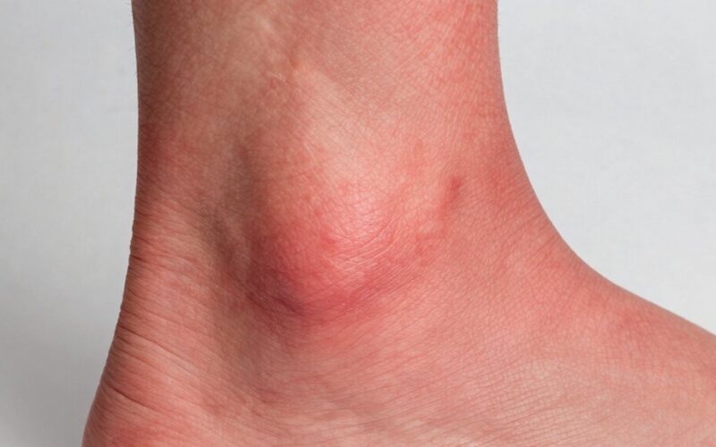 staiga patinusi raudona koja