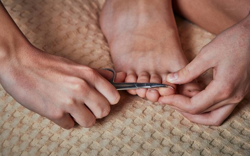 sustorėję kojų nagai priežastys ir prevencija