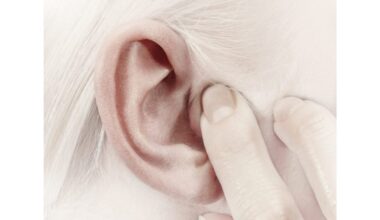 tinnitusas ir susijusios būklės