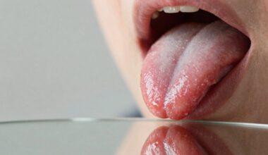 liežuvis rodo vidinę ligą