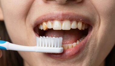 du kritiniai dantų valgantys