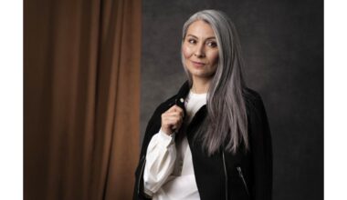 kai žili plaukai kelia susirūpinimą