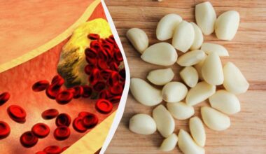 česnakai gali mažinti cholesterolio kiekį