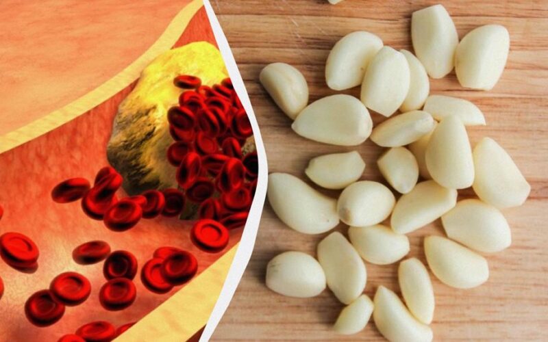 česnakai gali mažinti cholesterolio kiekį